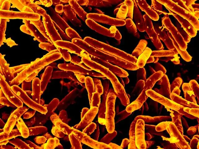 The image shows a close up of a group of yellow and orange streptococcus bacteria against a black...